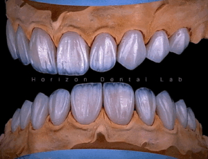Horizon Dental Lab