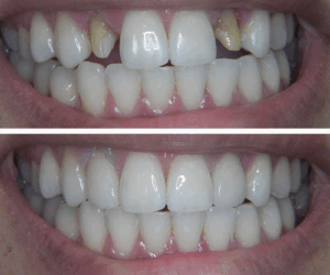 Middle East Dental Laboratory
